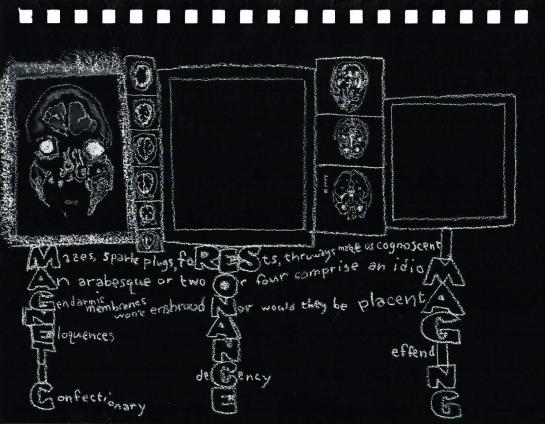 2019 0802 mri stage 3