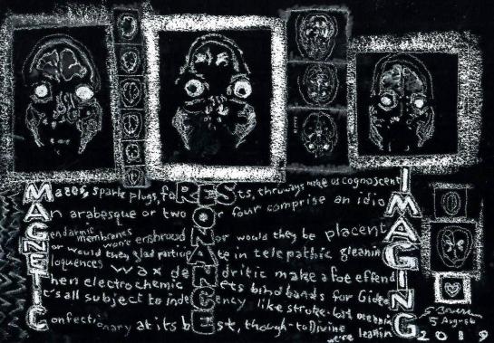 2019 0805 mri finish